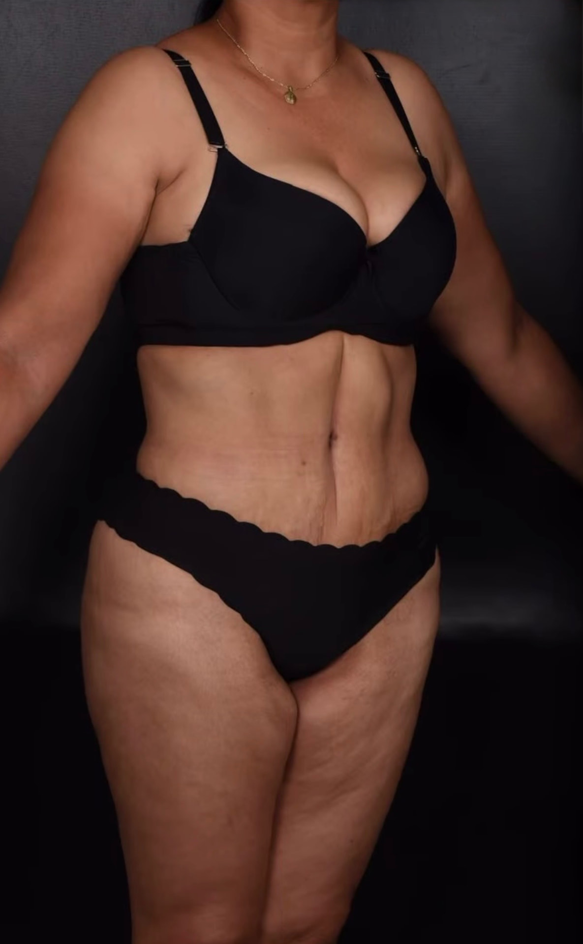 Después